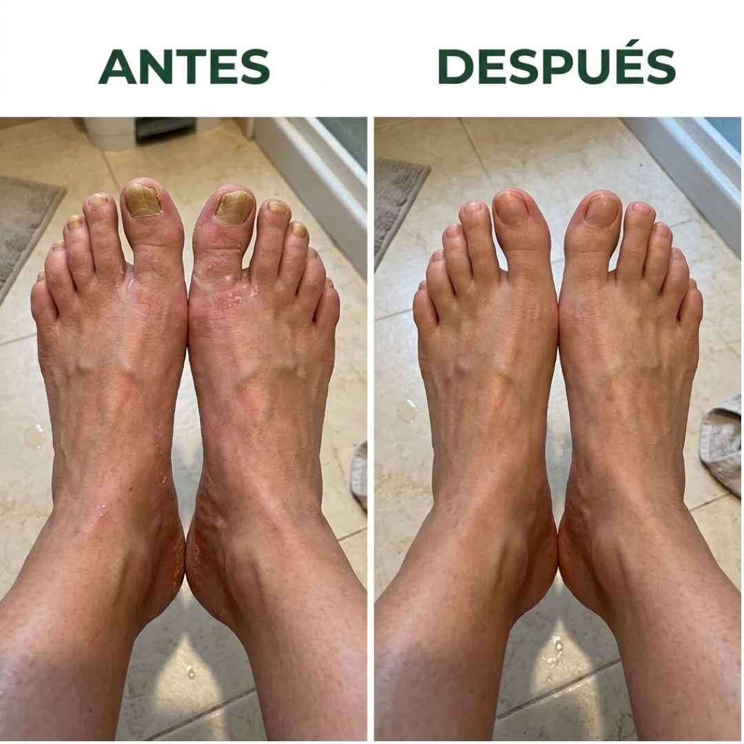 Cápsulas de Aceite de Orégano 6.000mg (60 uds)